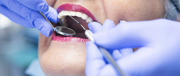 Best Emergency Root Canal Treatment in Ravenswood, WV